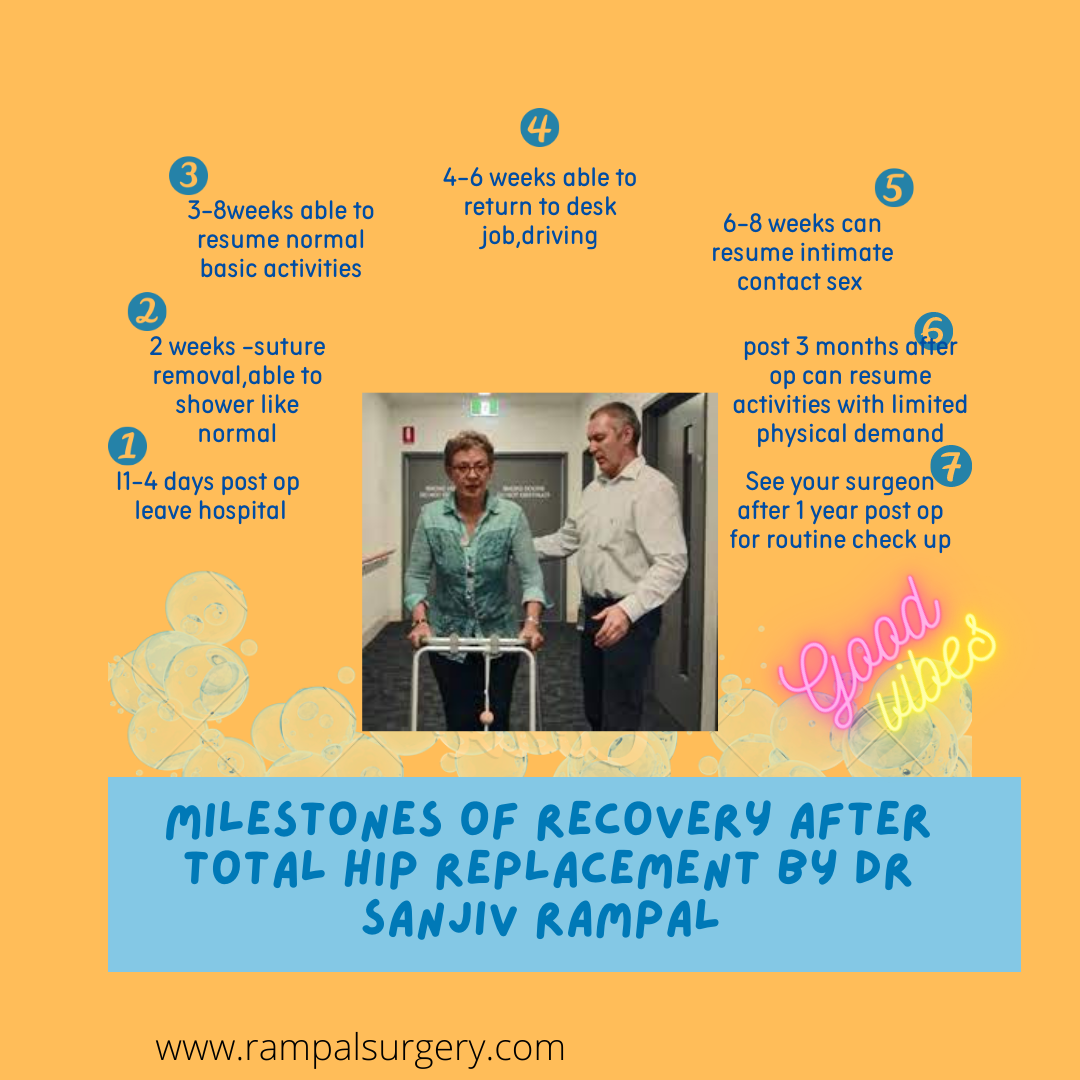 TOTAL HIP REPLACEMENT TIME BASED MILESTONES OF RECOVERY BY DR SANJIV RAMPAL ORTHOPAEDIC CONSULTANT KUALA LUMPUR