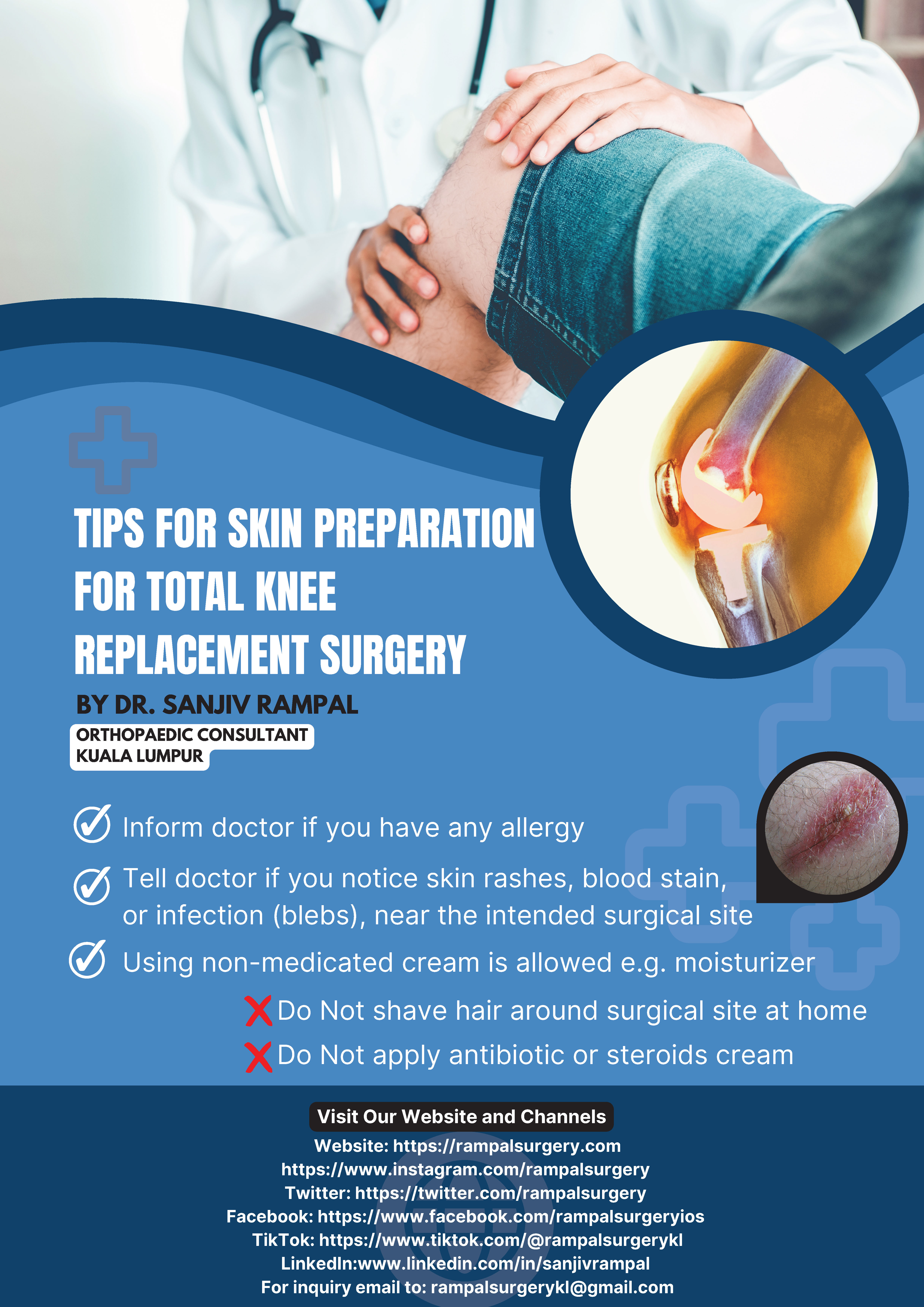 Tips for Skin Preparation for Total Knee Replacement Surgery by Dr Sanjiv Rampal, Orthopaedic Consultant Kuala Lumpur