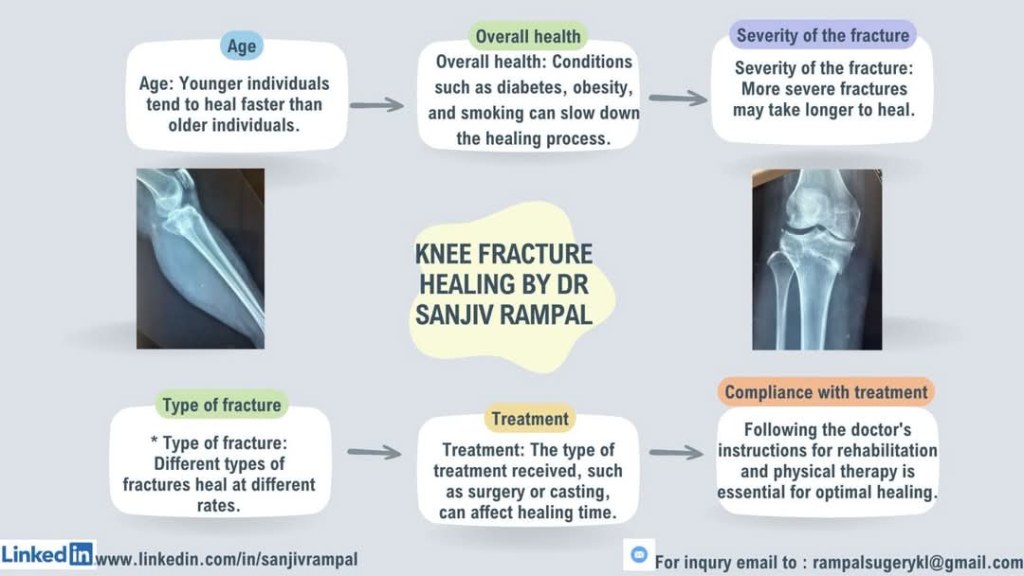 Knee Fracture Healing by Dr Sanjiv Rampal Orthopaedic Consultant Specialist Kuala Lumpur